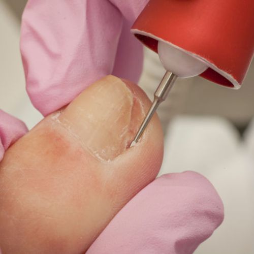 Mobile Foot Care Saskatoon
