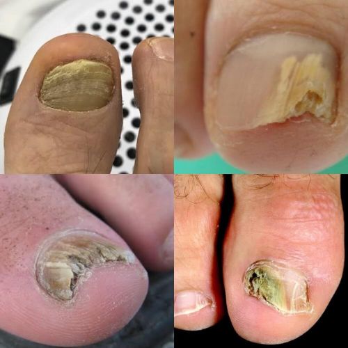 Mobile Foot Care Saskatoon